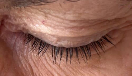 Customer photo review of COSTIQ® LASH SERUM