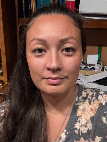 Customer photo review of 4 Glov Micro Infusion System Bundle + 12 Serums + 8 Pairs Microneedle Eye Patches