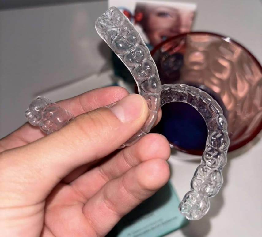 Customer photo review of Daily Retainer & Aligner Cleaner Tablets grape scented