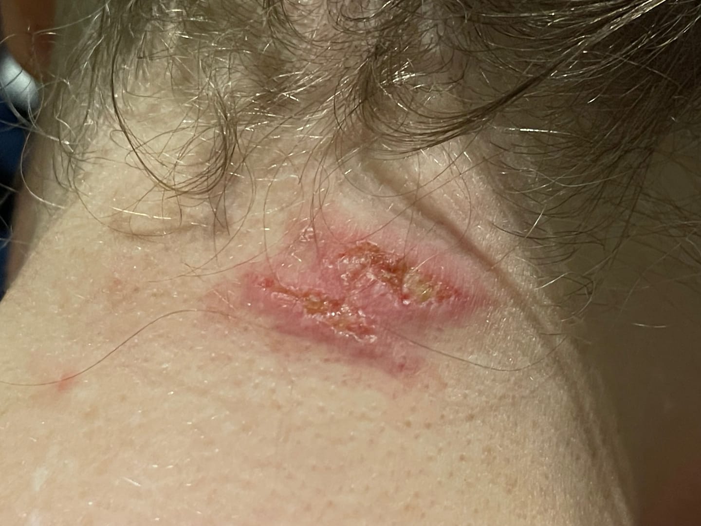 Customer photo review of GHK-Cu Yogurt Moisturizer