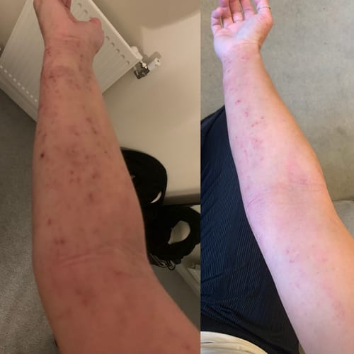 Customer photo review of Multi Strain Biotic