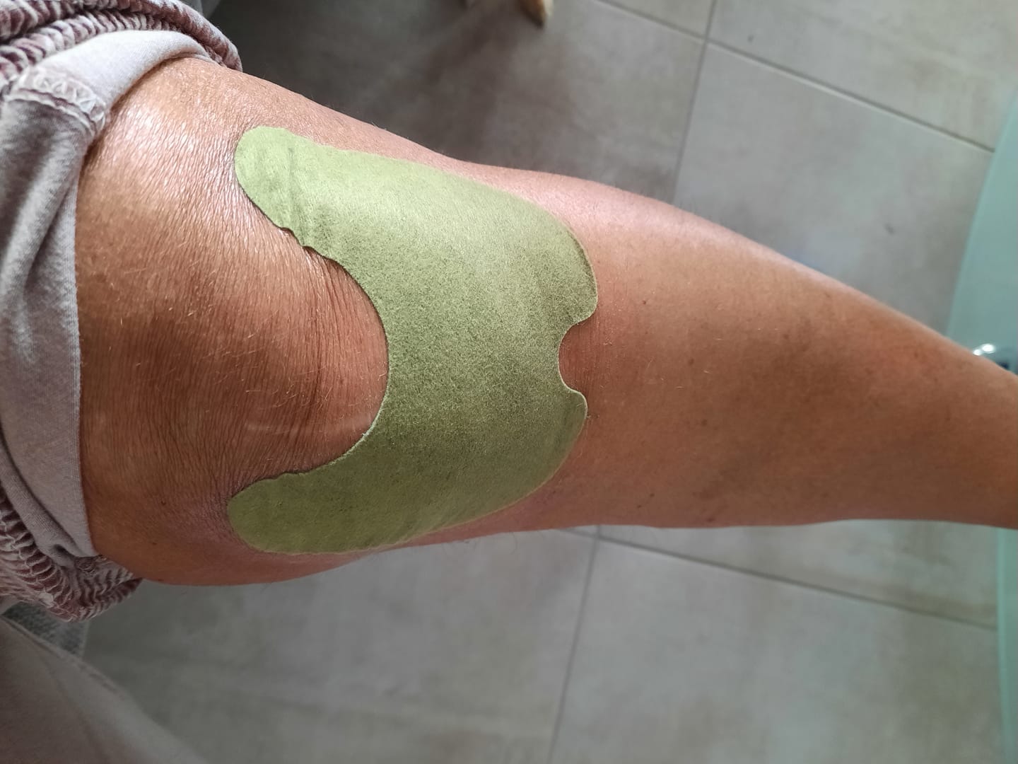 Customer photo review of Patchs anti-douleur