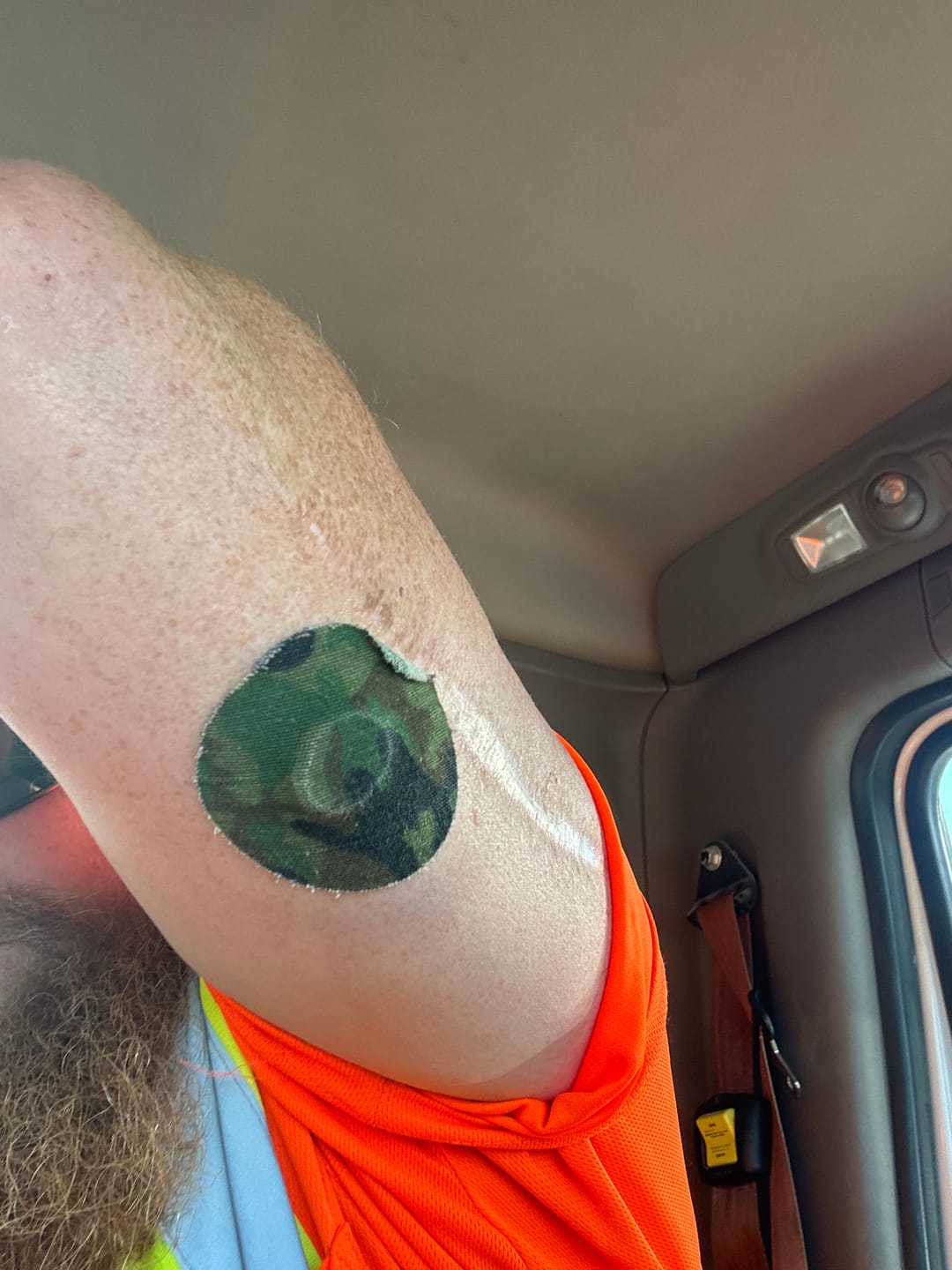 Customer photo review of Skin Grip Original - Dexcom G7 Adhesive Patches