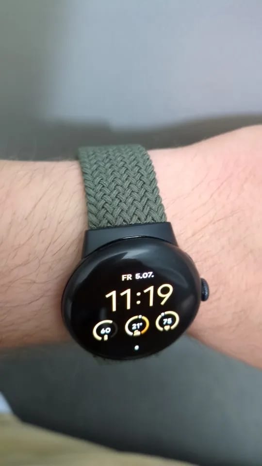 Customer photo review of Google Pixel Nylon Strap - Stylish, Durable, Versatile Band