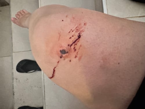 Customer photo review of גלגל פציעות ואפקטים מיוחדים לאיפור מקצועי מבית מרון