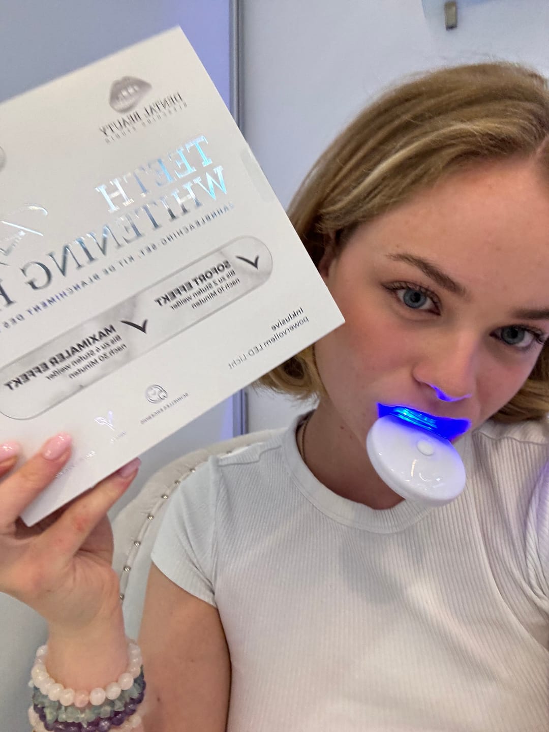 Customer photo review of Zahnbleaching-Set Rapid+
