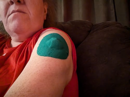 Customer photo review of Skin Grip Original - Medtronic Guardian/Enlite Adhesive Patches