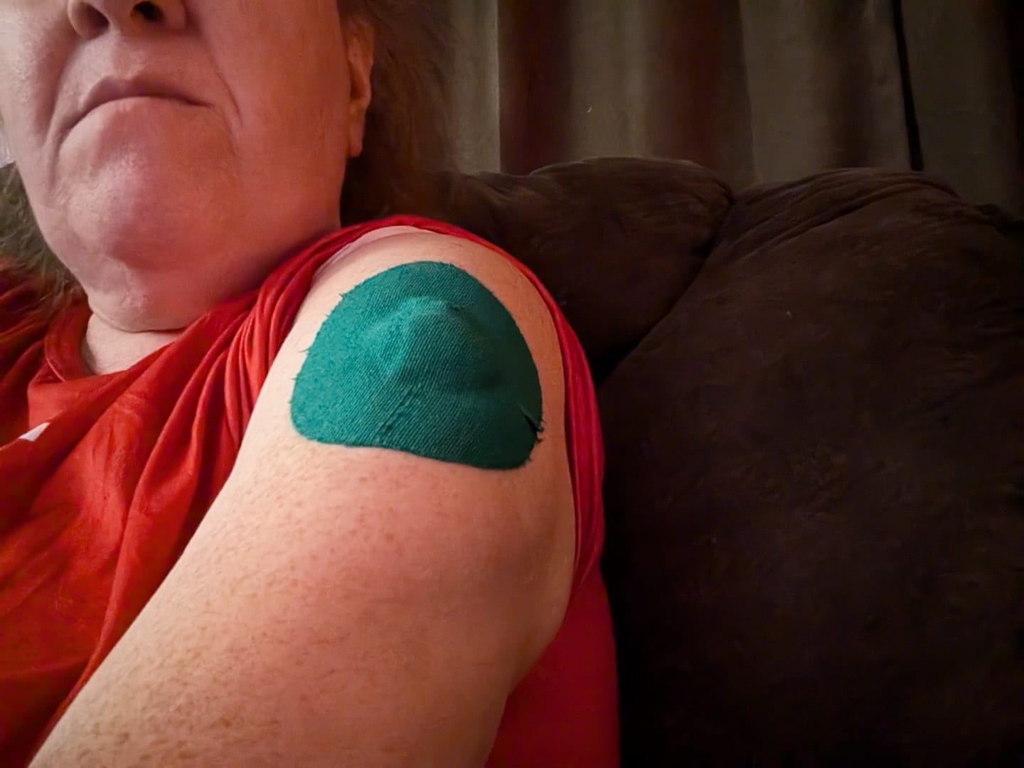 Customer photo review of Skin Grip Original - Medtronic Guardian/Enlite Adhesive Patches