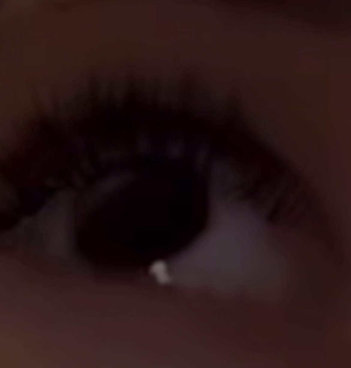 Customer photo review of Eyeling Custom Lens (1 month)