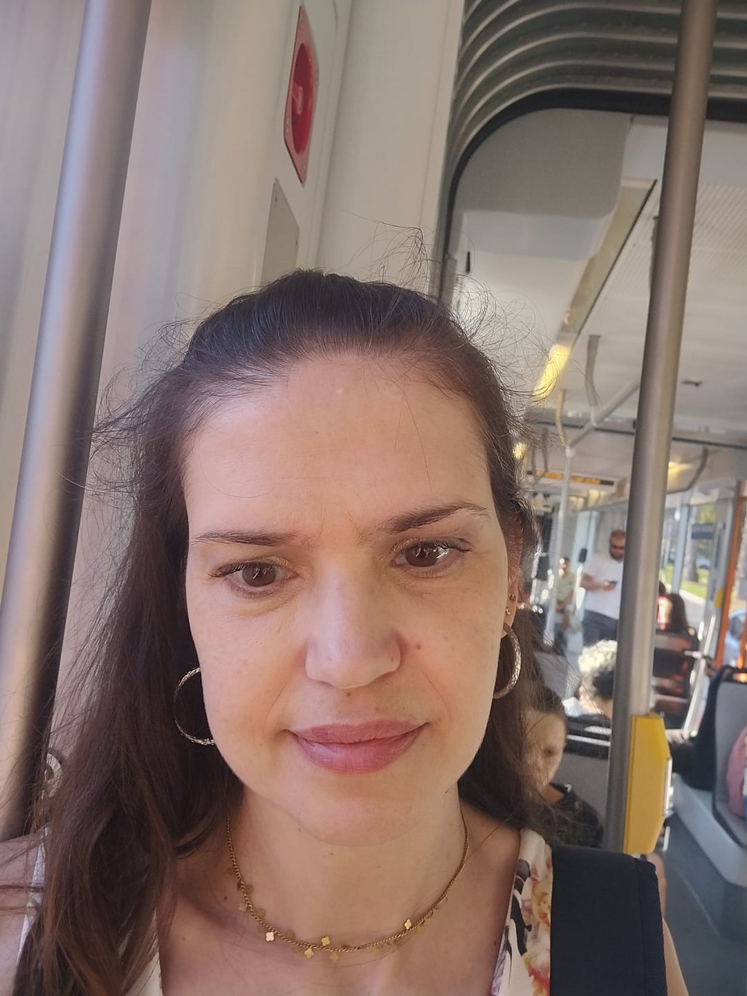 Customer photo review of EvenSkyn® Venus: Premium Eyelid Anti-Aging Device