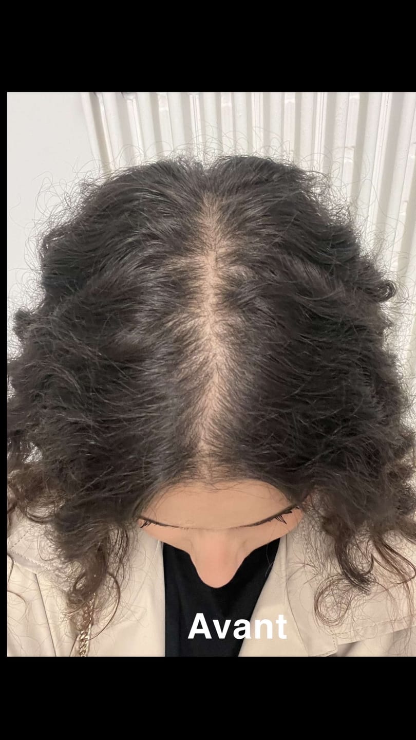 Customer photo review of Shampoing Solide Gingembre Anti chute & Pousse de cheveux - ECLAMA