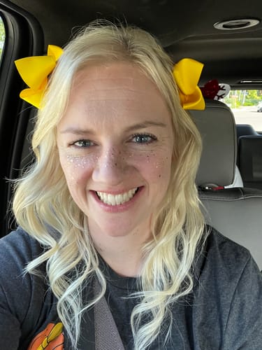 Customer photo review of Gold Glitter Freckles Makeup Patches