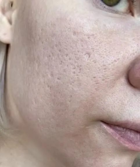 Customer photo review of Sensitiv Skin Set