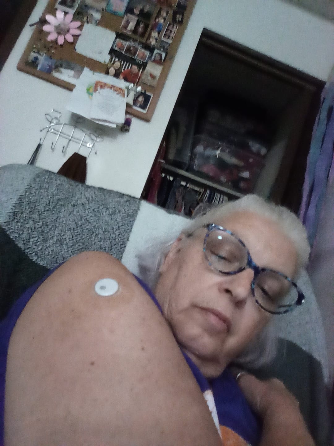 Customer photo review of Skin Grip Original - Libre 3 Adhesive Patches