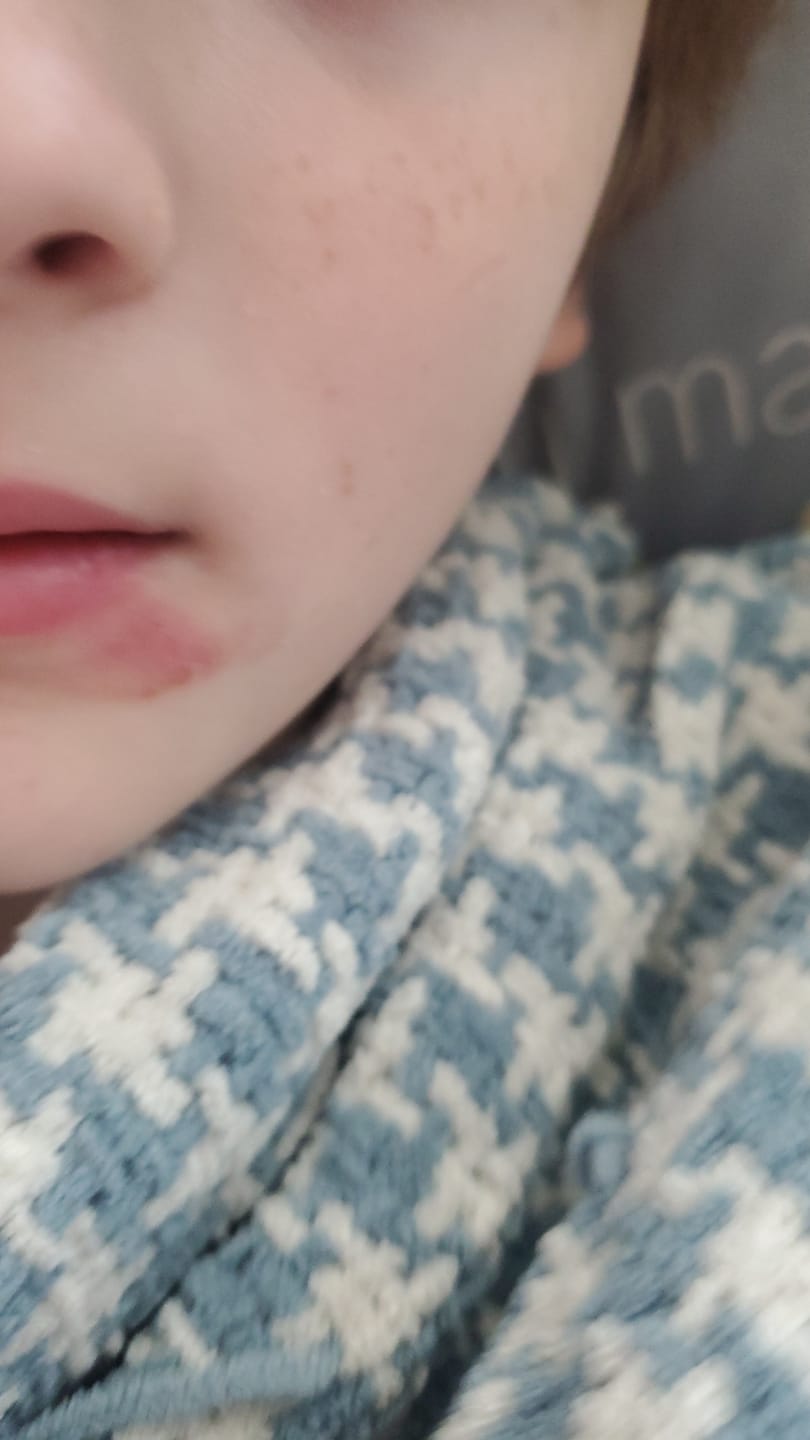 Customer photo review of Tallow and Castor Oil Chubby Stick