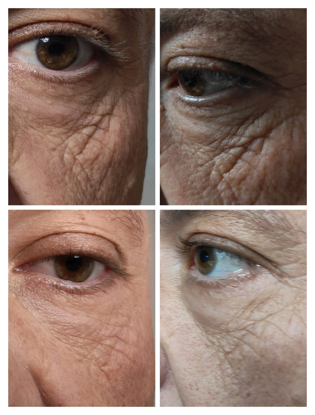 Customer photo review of Siero Viso Antietà