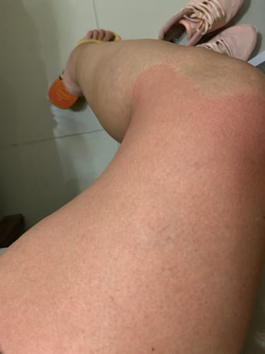 Customer photo review of Kit Ritual de Renovação