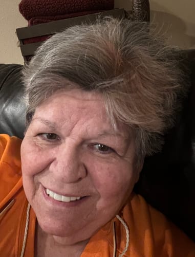 Customer photo review of Weekly Payment Plan - Pop On Veneers with At Home Impression Kit