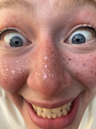 Customer photo review of Gold + Silver + Rose Speckles Makeup Patches