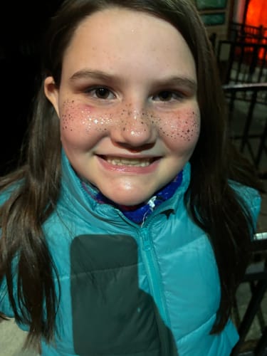 Customer photo review of Gold + Silver Speckles Makeup Patches