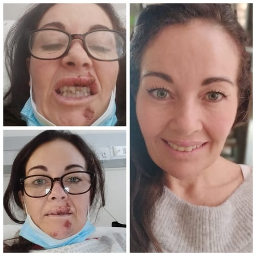 Customer photo review of Glow From Within Collagen - 250g | PINK LIMITED EDITION