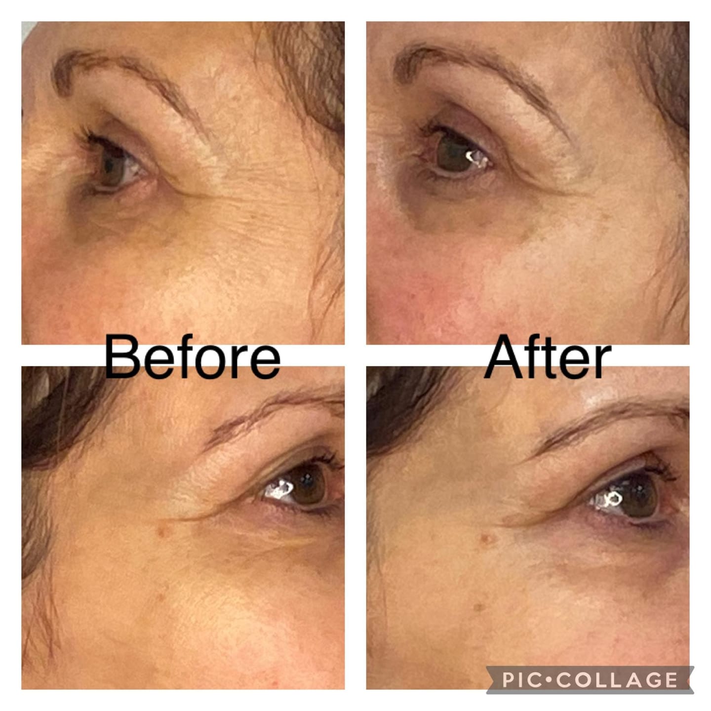 Customer photo review of Anti-Fatigue Eye Mask