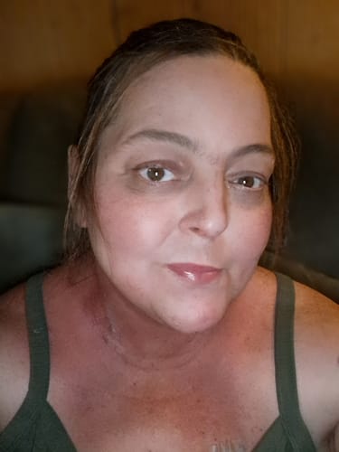 Customer photo review of Comprehensive Skincare Support for Chemotherapy & Radiation Patients