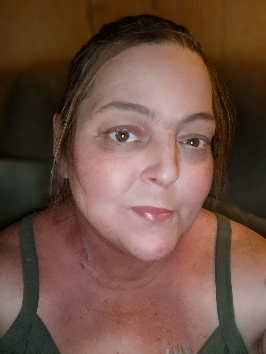 Customer photo review of Comprehensive Skincare Support for Chemotherapy & Radiation Patients