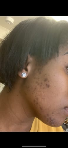 Customer photo review of Turmeric Glow Soap