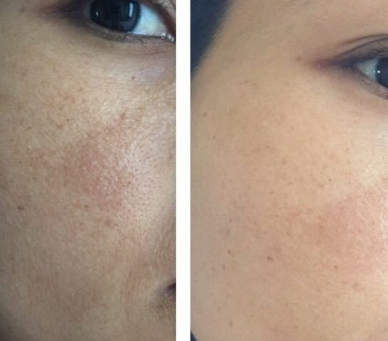 Customer photo review of Ultra C: Vitamin C Serum