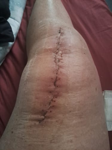 Customer photo review of Miracle Balm