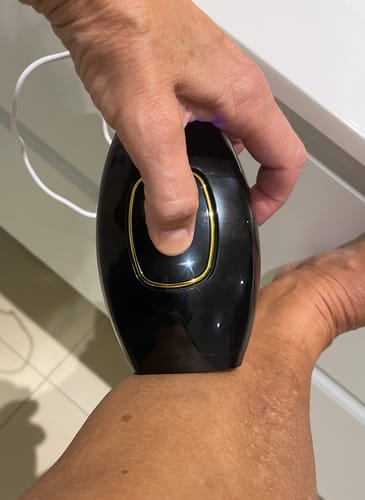 Customer photo review of IPL - Permanent hårfjerner