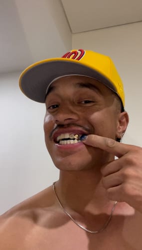 Customer photo review of PRISM (GOLD GRILLZ)