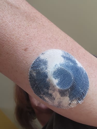 Customer photo review of Skin Grip Original - Dexcom G7 Adhesive Patches