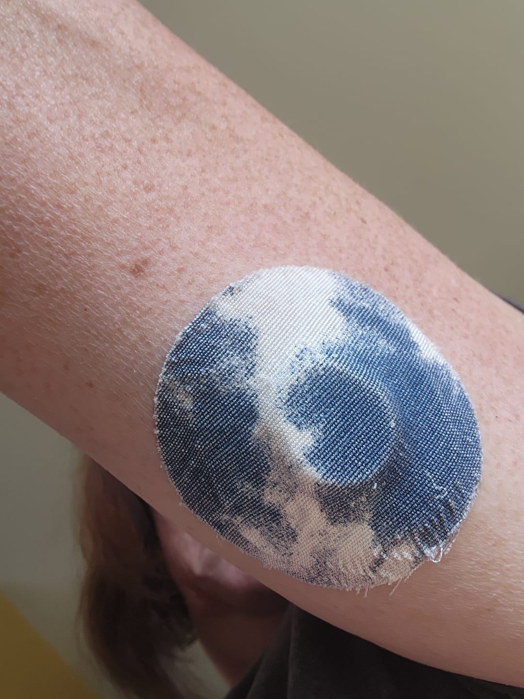 Customer photo review of Skin Grip Original - Dexcom G7 Adhesive Patches