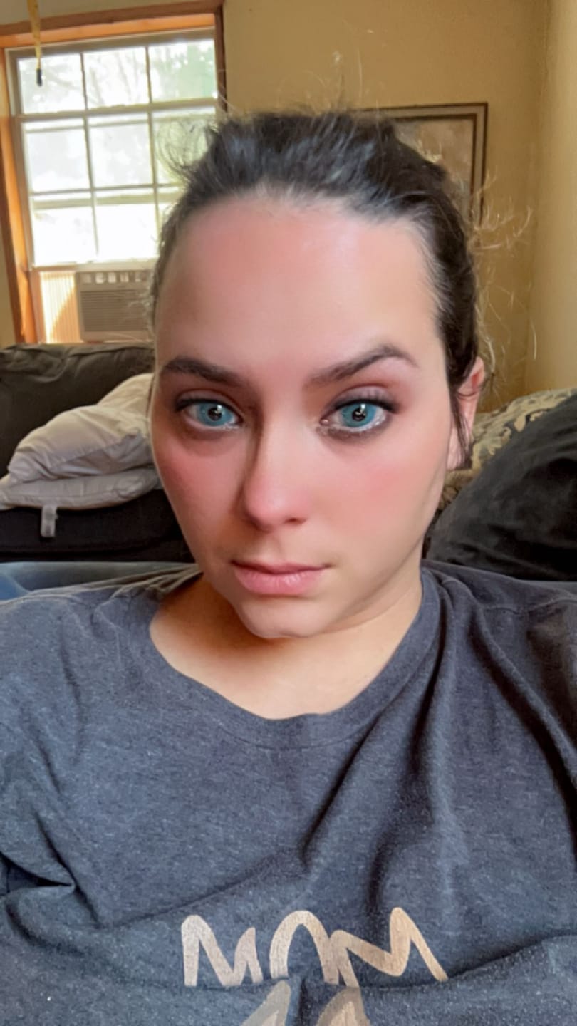 Customer photo review of Pixie Blue Prescription Coloured Contact Lenses