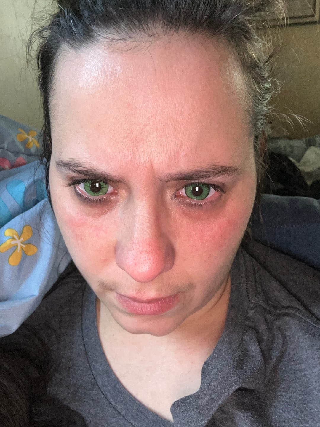 Customer photo review of Vega Bright Forest Green Prescription Colored Contact Lenses