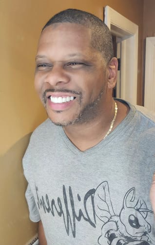 Customer photo review of Teeth-Veneer 2.0