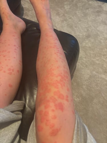 Customer photo review of Multi Strain Biotic