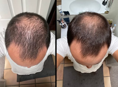 Customer photo review of Thickening Shampoo