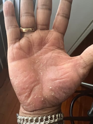 Customer photo review of Scalp & Skin Rebuilder 4oz (3 Flavors)