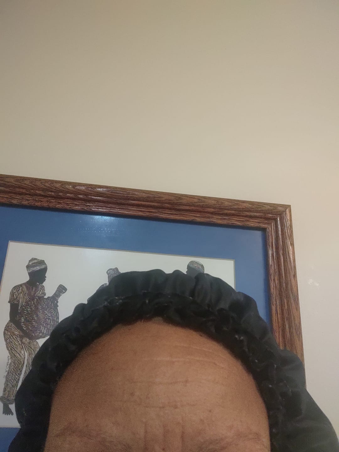 Customer photo review of Glow Wash Salicylic Acid + Sulphur  Facial Cleanser