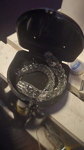 Customer photo review of Upper and Lower Retainers Set