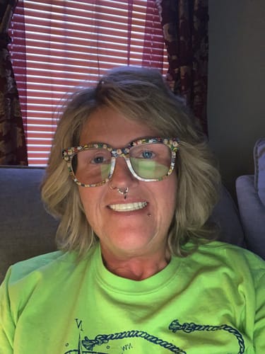 Customer photo review of Weekly Payment Plan - Pop On Veneers with At Home Impression Kit