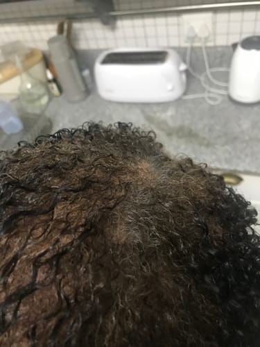 Customer photo review of Hair & Nail Capsules
