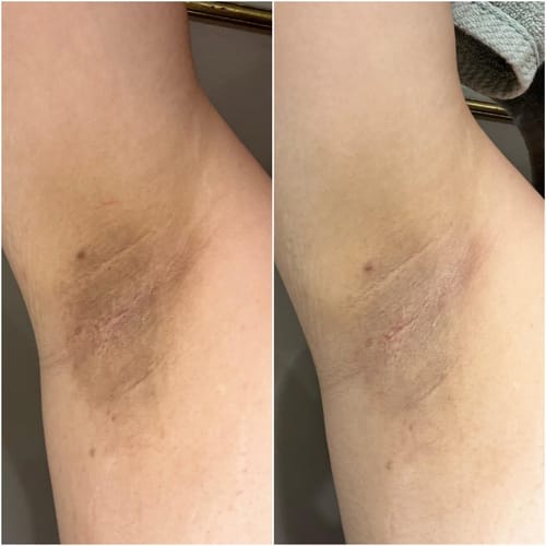 Customer photo review of Intimate Lightening Cream