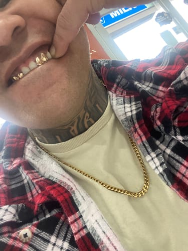 Customer photo review of NOVA (GOLD GRILLZ)