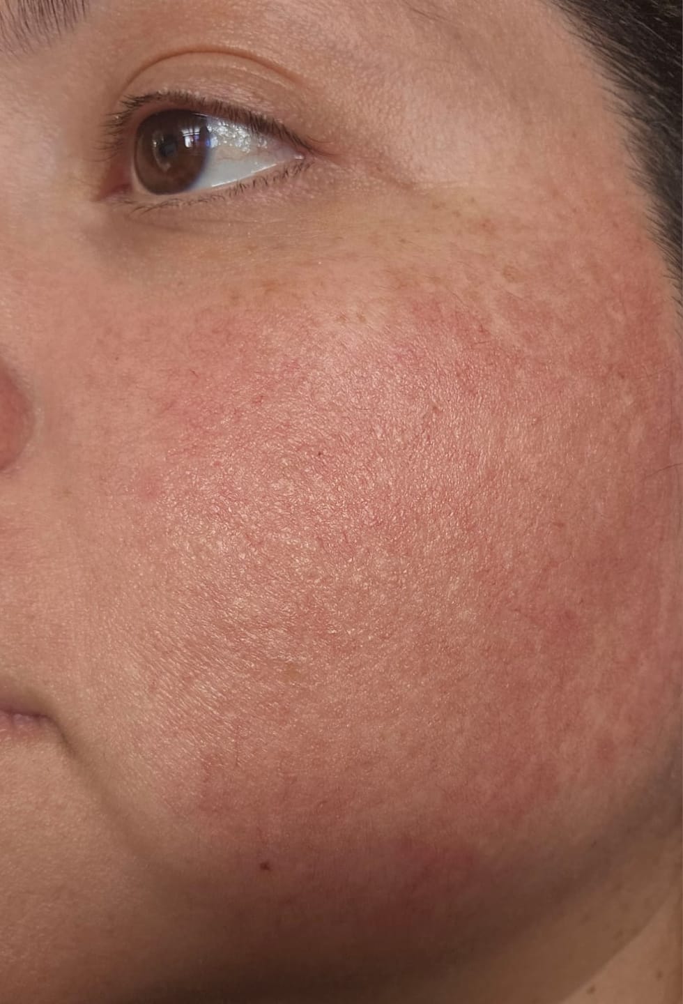 Customer photo review of Pack Revitaliza tu Rostro