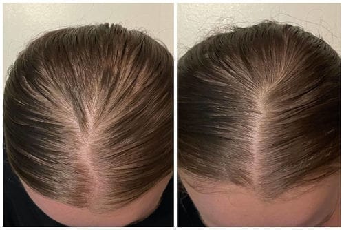 Customer photo review of SPARTAN™ - Root Activator Spray