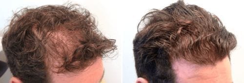 Customer photo review of SPARTAN™ - Root Activator Spray